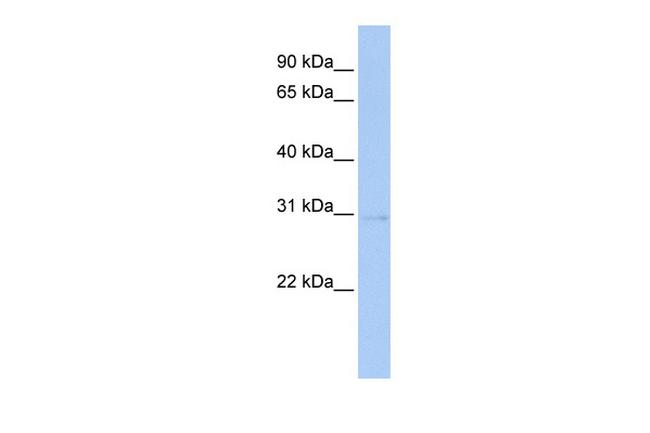 STK16 Antibody in Western Blot (WB)