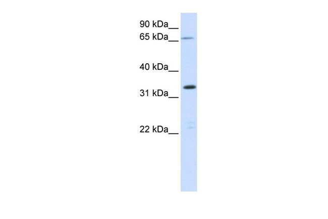 C19orf47 Antibody in Western Blot (WB)