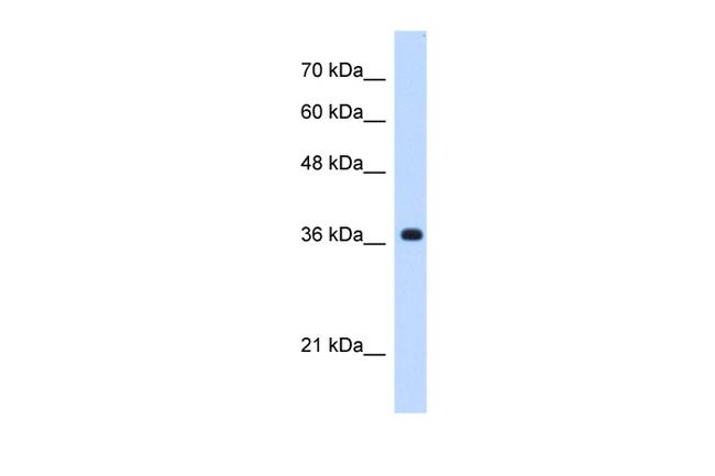 C19orf47 Antibody in Western Blot (WB)