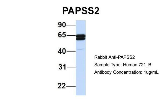 PAPSS2 Antibody in Western Blot (WB)