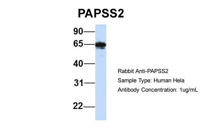 PAPSS2 Antibody in Western Blot (WB)