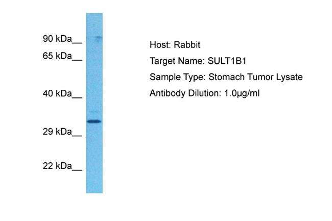 SULT1B1 Antibody in Western Blot (WB)