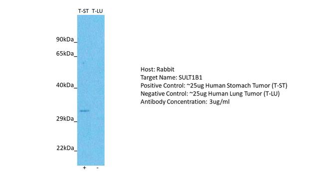 SULT1B1 Antibody in Western Blot (WB)