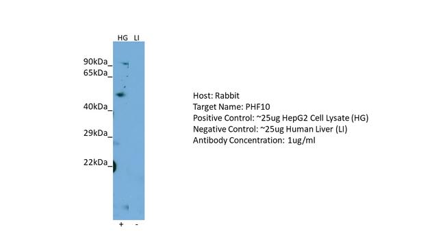 PHF10 Antibody in Western Blot (WB)