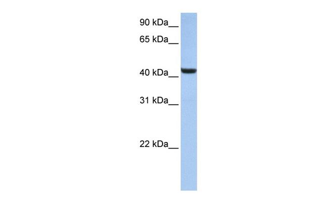 B3GNT7 Antibody in Western Blot (WB)