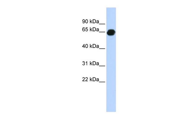 B3GALNT2 Antibody in Western Blot (WB)