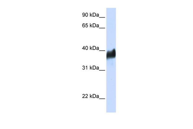 CLN8 Antibody in Western Blot (WB)