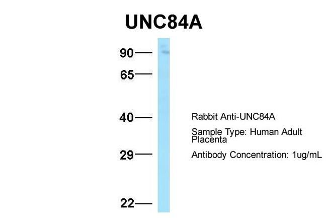 UNC84A Antibody in Western Blot (WB)