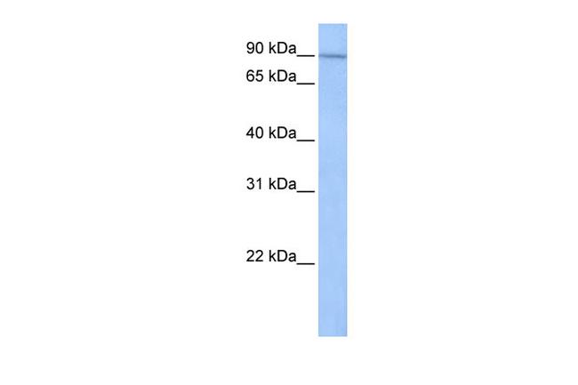 UNC84A Antibody in Western Blot (WB)