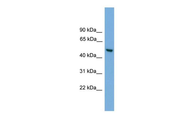 ABHD1 Antibody in Western Blot (WB)