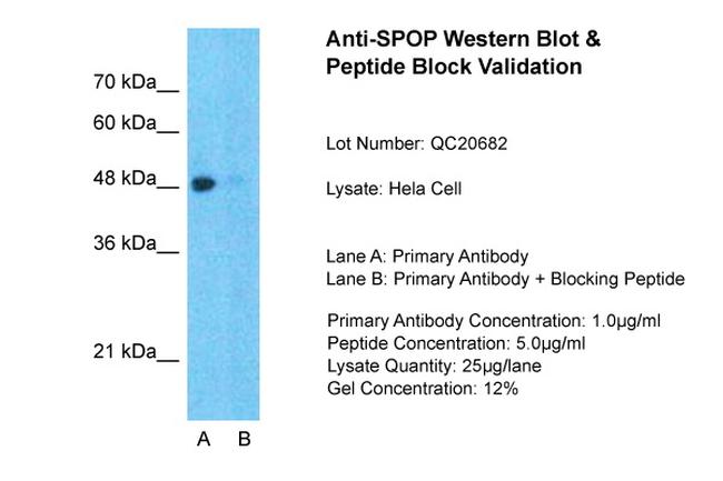 SPOP Antibody in Western Blot (WB)