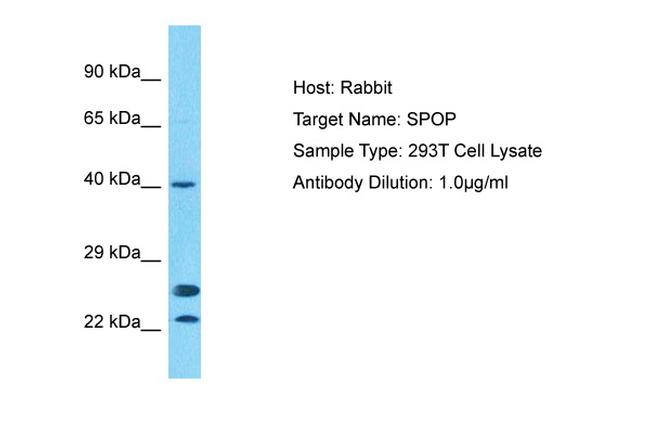 SPOP Antibody in Western Blot (WB)