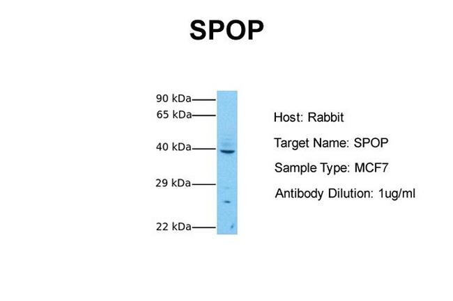 SPOP Antibody in Western Blot (WB)