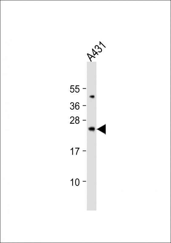 BAD Antibody in Western Blot (WB)