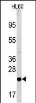 BAD Antibody in Western Blot (WB)