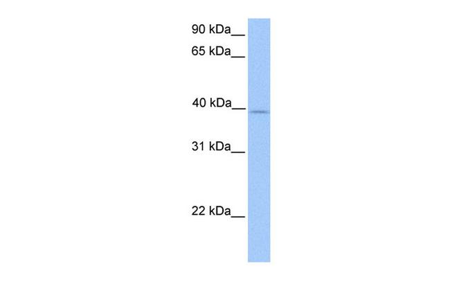 ZFP92 Antibody in Western Blot (WB)