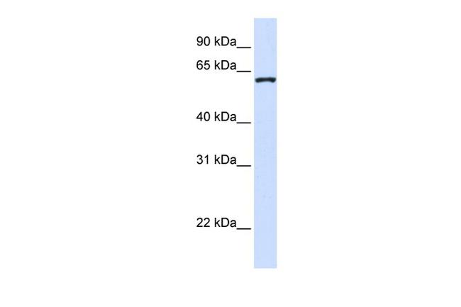 DCAF12 Antibody in Western Blot (WB)