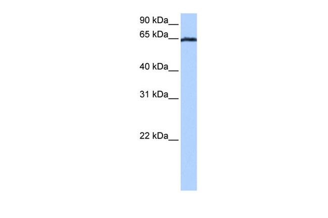 EBF4 Antibody in Western Blot (WB)