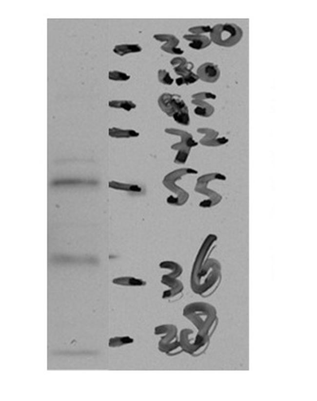 CETP Antibody in Western Blot (WB)