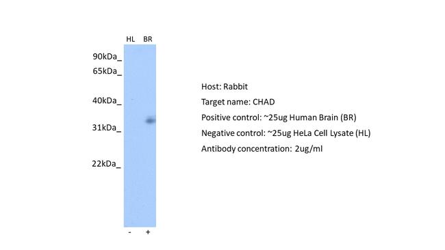 CHAD Antibody in Western Blot (WB)