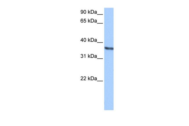 CHAD Antibody in Western Blot (WB)