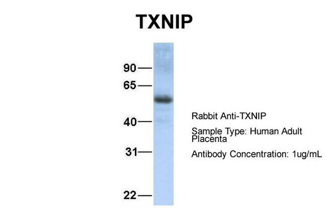 TXNIP Antibody in Western Blot (WB)