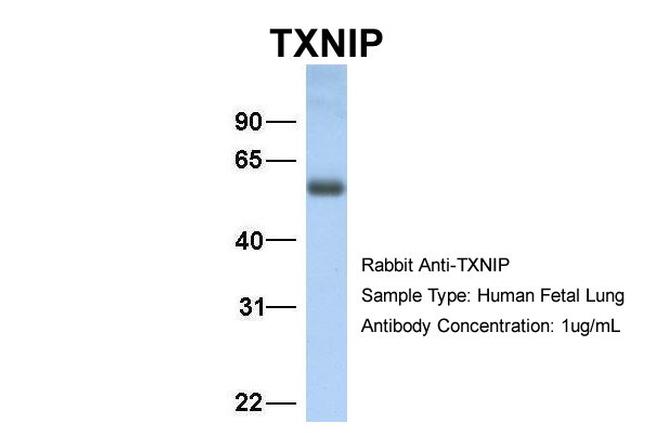 TXNIP Antibody in Western Blot (WB)