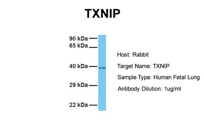 TXNIP Antibody in Western Blot (WB)