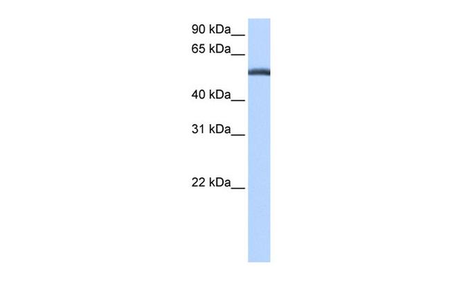 LACTB Antibody in Western Blot (WB)