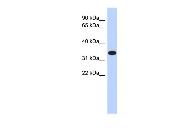 ACTRT1 Antibody in Western Blot (WB)