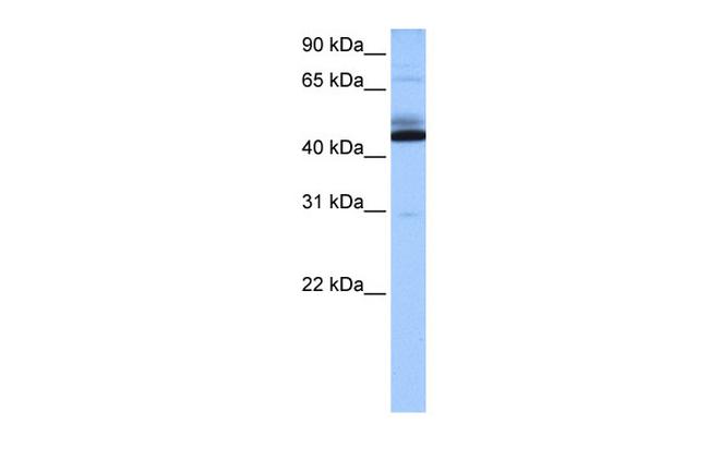 C15orf27 Antibody in Western Blot (WB)