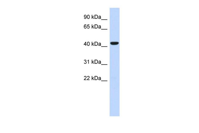 SGMS2 Antibody in Western Blot (WB)