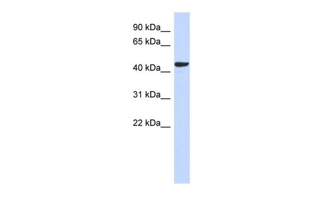 SGMS2 Antibody in Western Blot (WB)