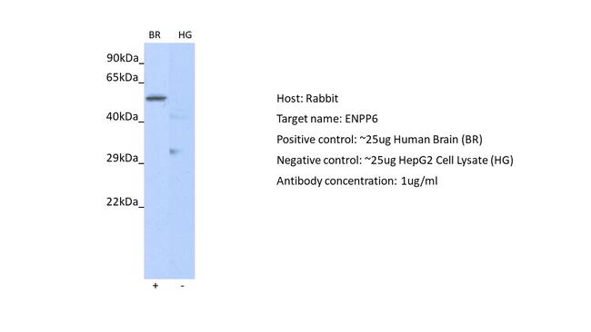 ENPP6 Antibody in Western Blot (WB)