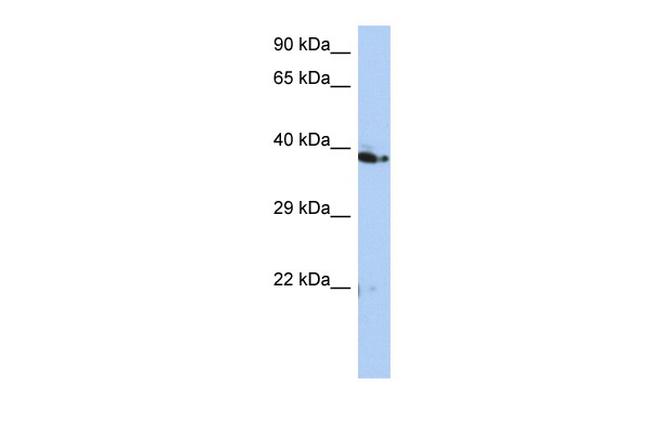 C10orf46 Antibody in Western Blot (WB)