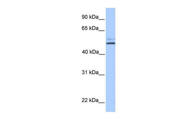 NHEDC2 Antibody in Western Blot (WB)