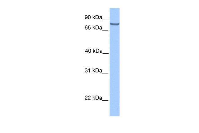 LCA5 Antibody in Western Blot (WB)