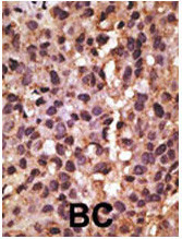 BNIP3 Antibody in Immunohistochemistry (Paraffin) (IHC (P))