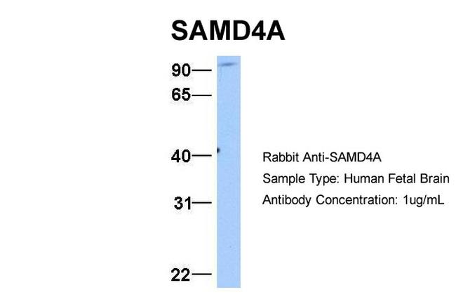 SAMD4A Antibody in Western Blot (WB)