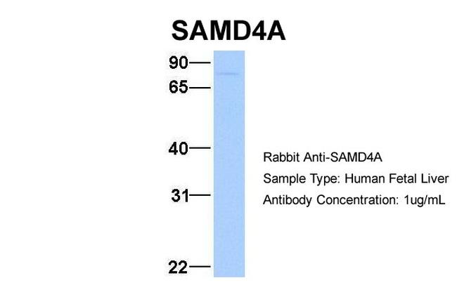 SAMD4A Antibody in Western Blot (WB)