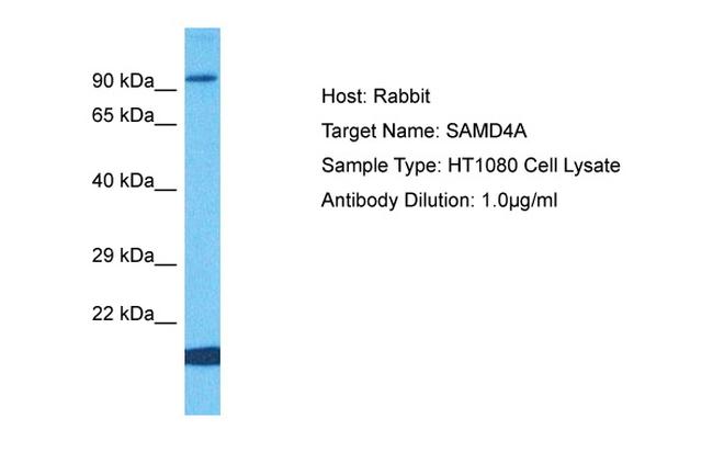 SAMD4A Antibody in Western Blot (WB)