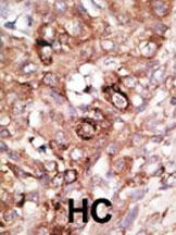 BAD Antibody in Immunohistochemistry (Paraffin) (IHC (P))