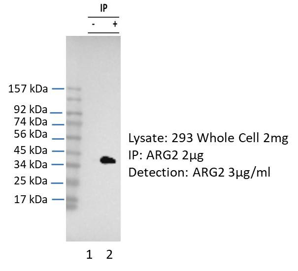 Arginase 2 Antibody in Immunoprecipitation (IP)