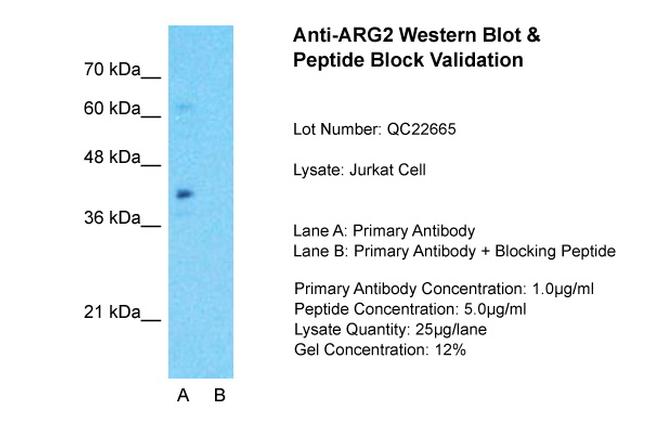 Arginase 2 Antibody in Western Blot (WB)