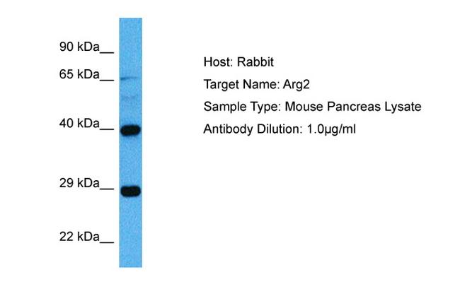 Arginase 2 Antibody in Western Blot (WB)