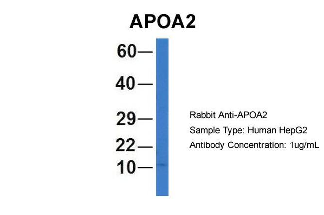 ApoA2 Antibody in Western Blot (WB)