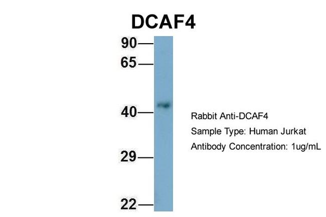 DCAF4 Antibody in Western Blot (WB)