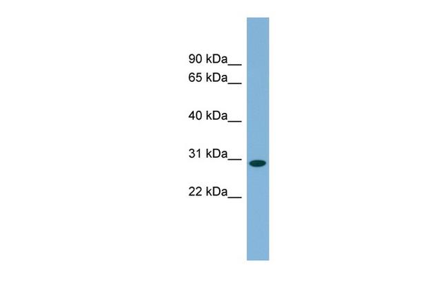 C11orf57 Antibody in Western Blot (WB)