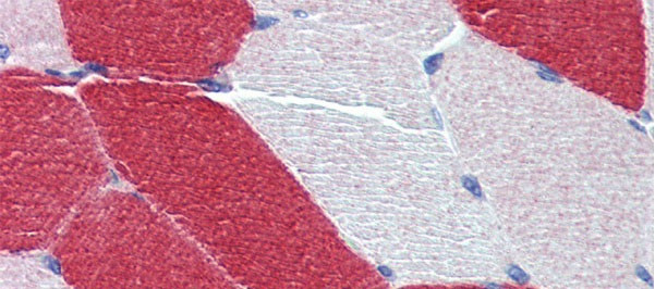 MYL6 Antibody in Immunohistochemistry (IHC)