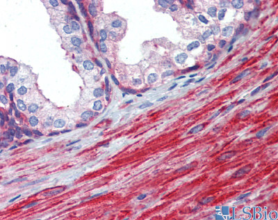 MYL6 Antibody in Immunohistochemistry (IHC)